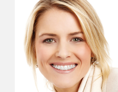Picture of a smiling white woman wearing braces